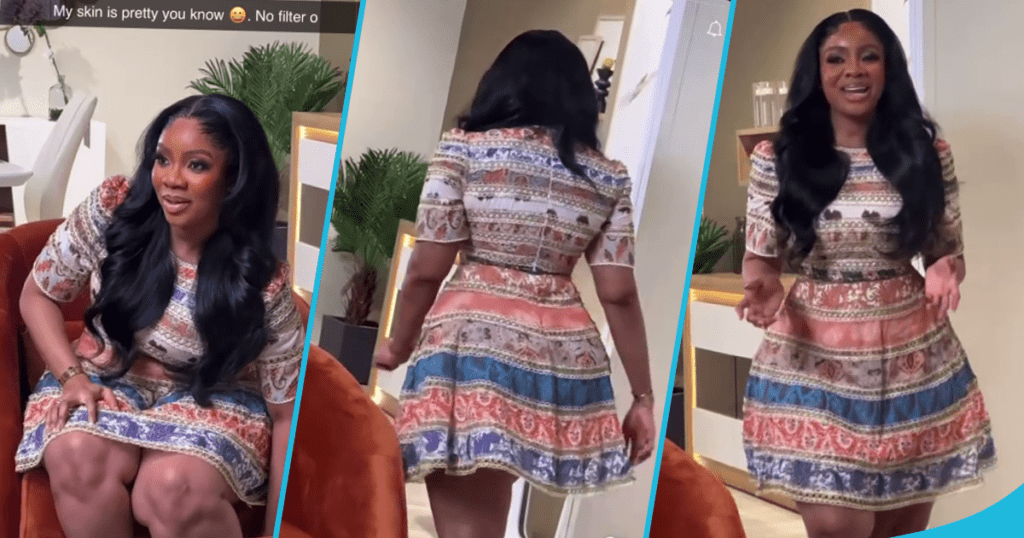 Serwaa Amihere Flaunts Bare Legs Without Scars In Colorful Mini