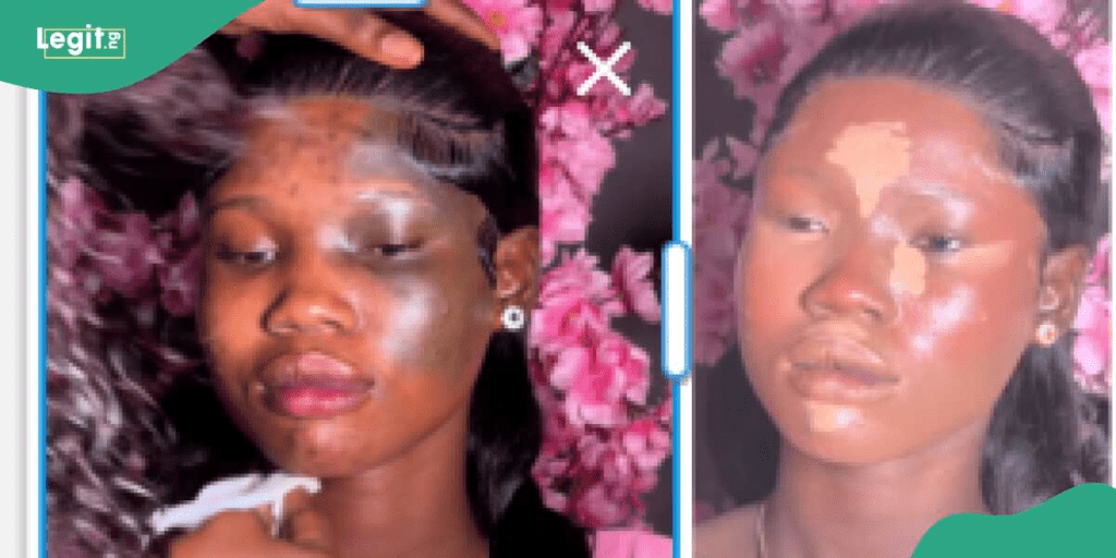 Makeup Artist Transforms Lady's Face With Black Patches, Looks Amazing: